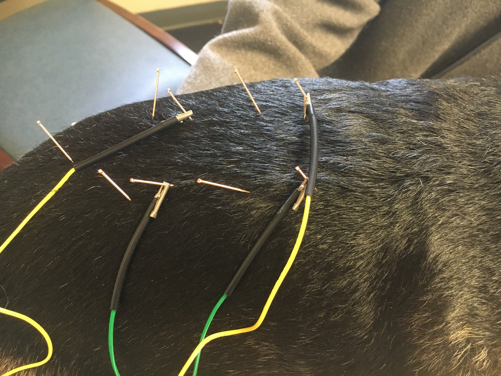 Acupuncture - Does it Work?