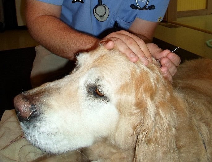 What Are the Benefits of Acupuncture?