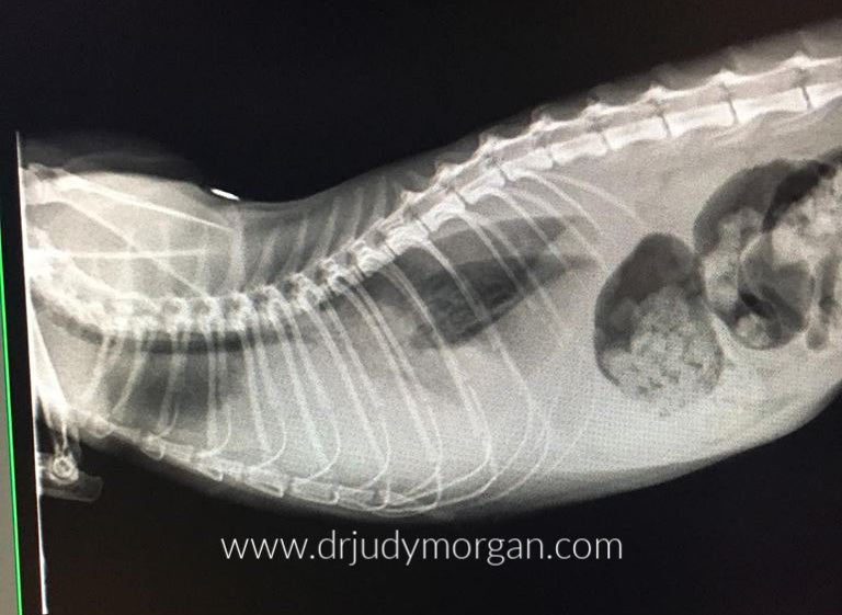 Dilated Cardiomyopathy