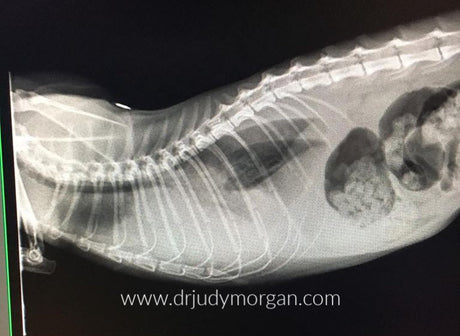 Dilated Cardiomyopathy