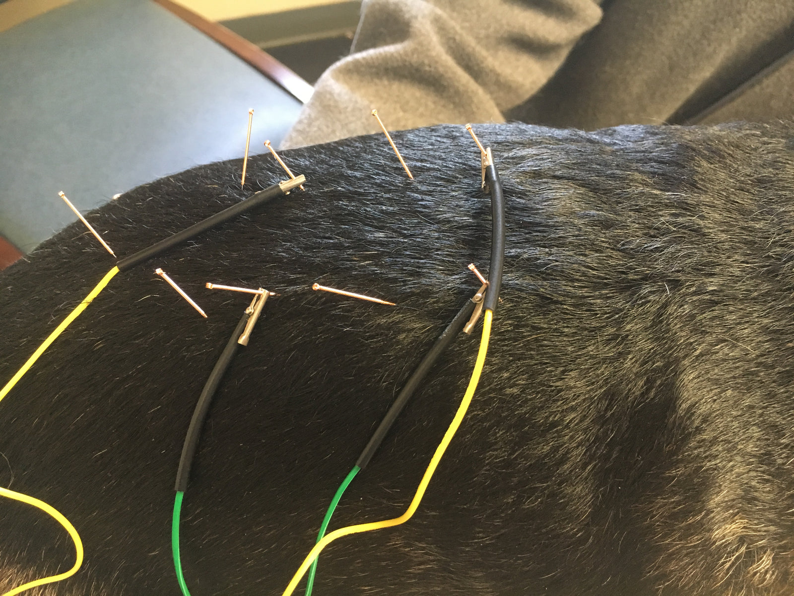 Acupuncture - Does it Work?