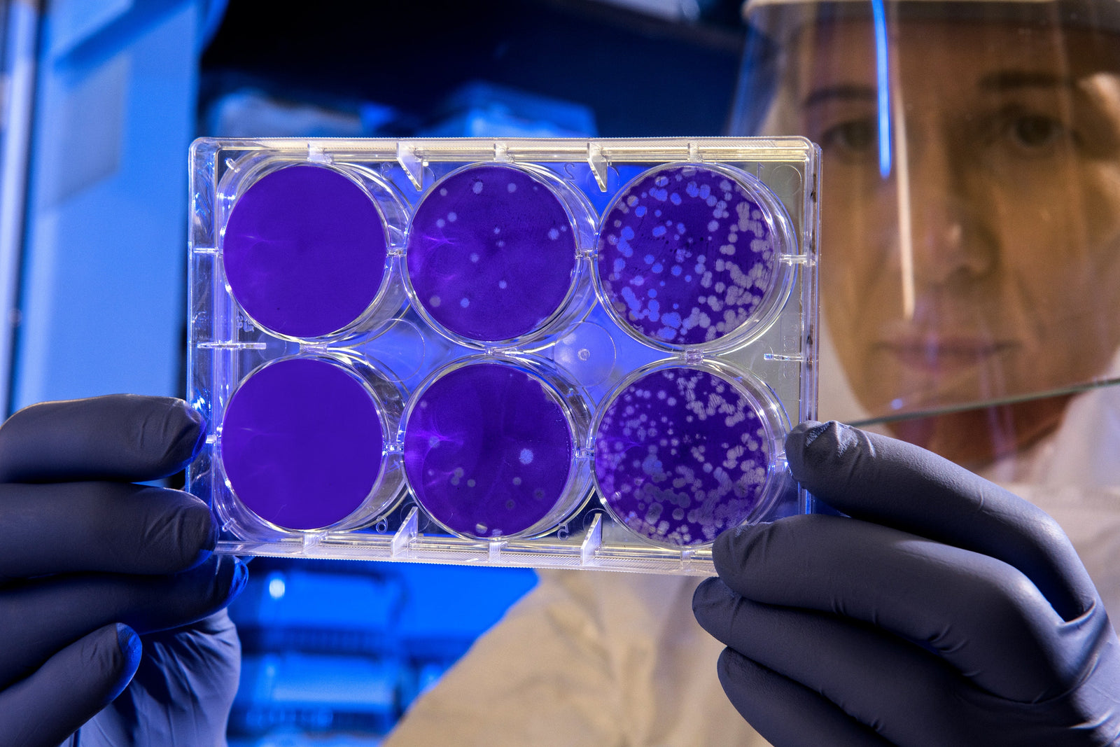 The World is a Petri Dish