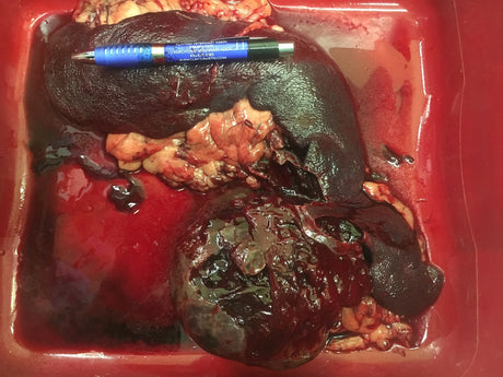 Hemangiosarcoma- Why Are More Dogs Dying of This Deadly Cancer?