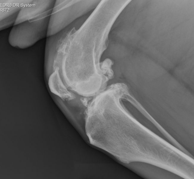 Treating Arthritis Naturally